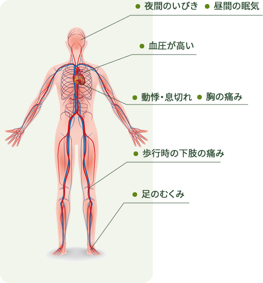 循環器内科のよくある病と症状