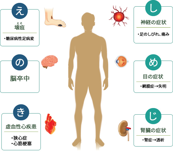 糖尿病の合併症は「し・め・じ」「え・の・き」